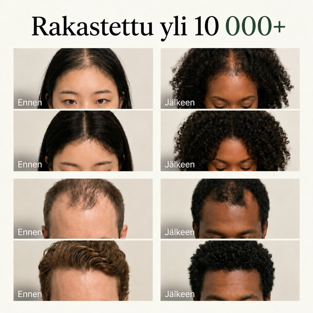Scalora™ Korealainen Hiuspohjahoito